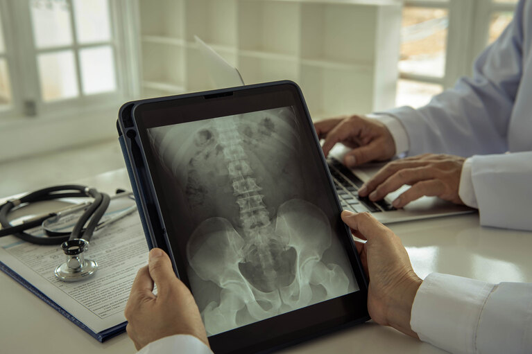 Portable x-ray system